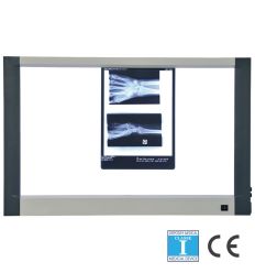 Négatoscope 2 plages extra-plat